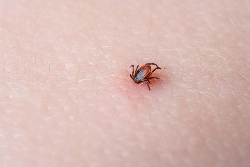 Nebudete věřit, co chrání před klíšťaty. Funguje lépe než sprej!